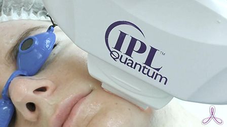 IPL-фотоомоложение: что это, кому подходит и какого эффекта ждать