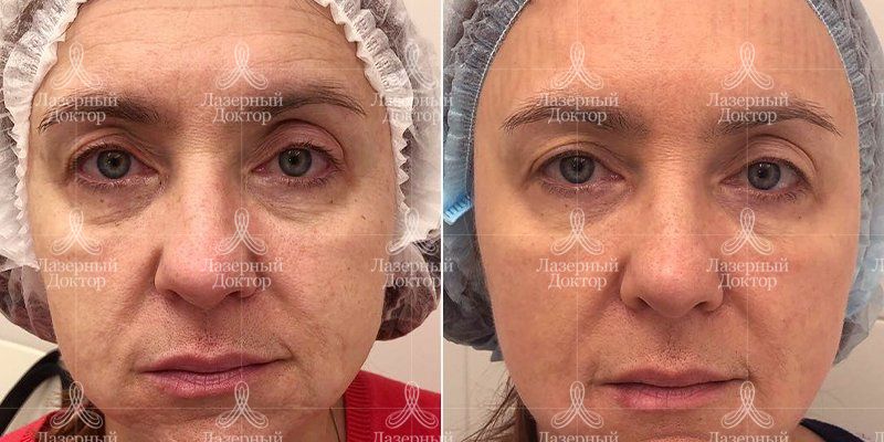 Дот омоложение