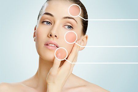 Лазерный пилинг лица – современный способ обновления кожи