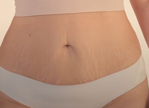 фото до после