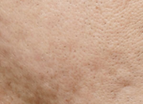 3D-волюмизация фото после