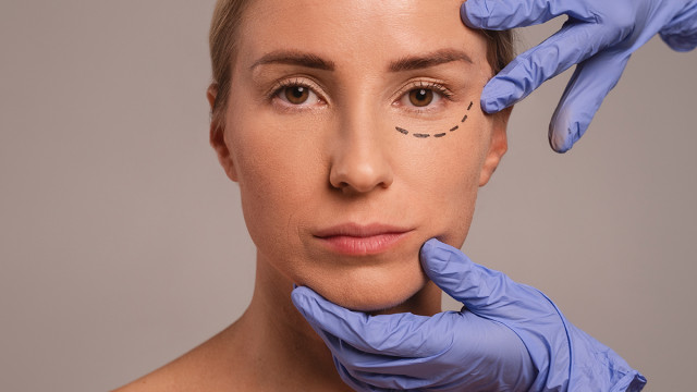 Нитевой лифтинг: что это, виды нитей для подтяжки лица и тела