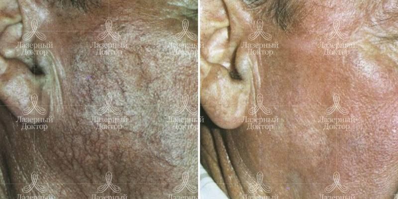 Квантум (Санкт-Петербург)