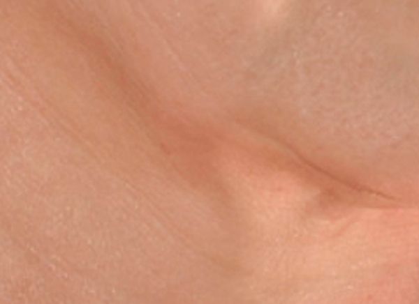 3D-волюмизация фото до и после