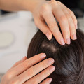 Лечение волос – дома или в клинике?
