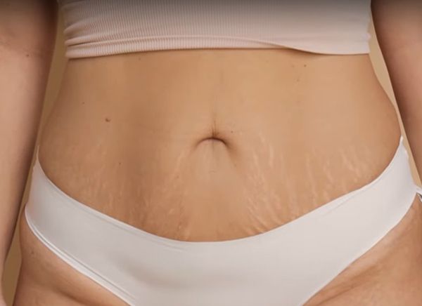 фото до после