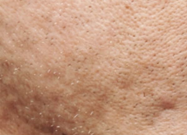 3D-волюмизация фото до