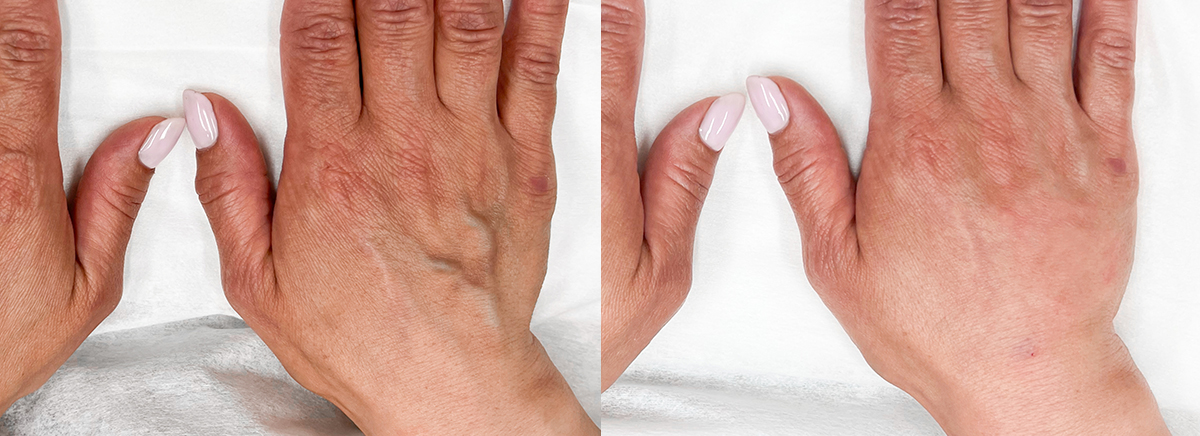 Пластика рук