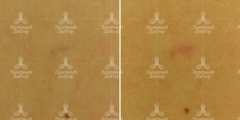 Удаление звездочек