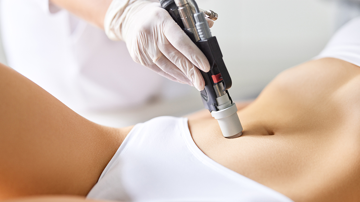 Лазерная эпиляция или шугаринг: что выбрать