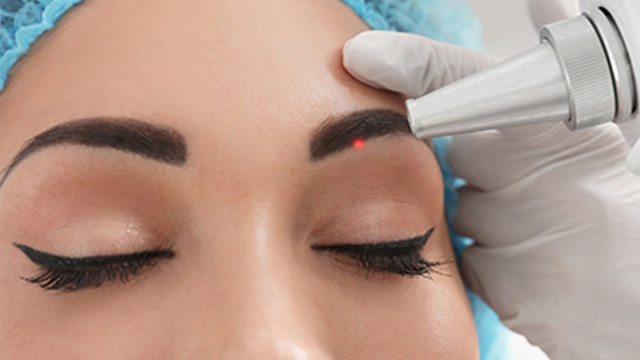 Перманентный макияж — не навсегда: как удалить татуаж без последствий