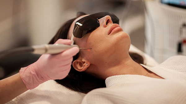 Лазерное экспресс-омоложение Fotona Smooth: плюсы, показания, как проходит процедура, уход до и после