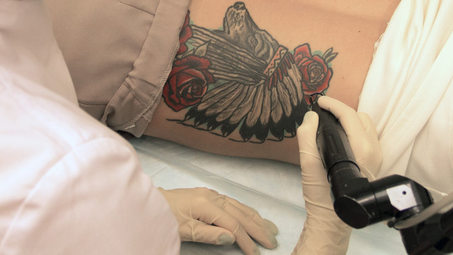 Как свести татуировку: методы удаления