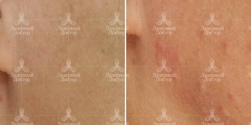 Фото до и после