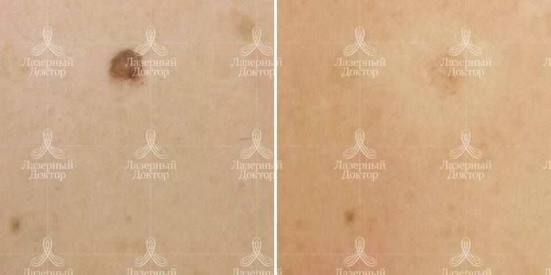 Фото до и после