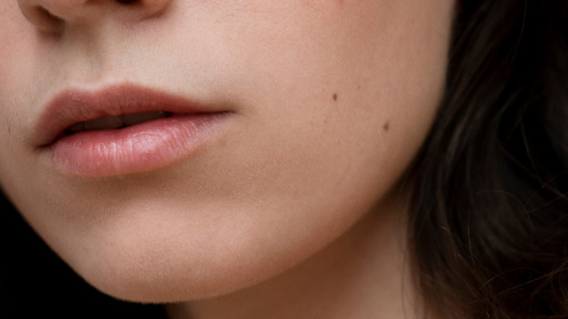 К какому врачу обращаться с родинками?