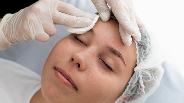 Подтяжка бровей нитями