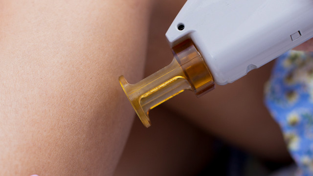 Что выбрать: лазерная или восковая эпиляция