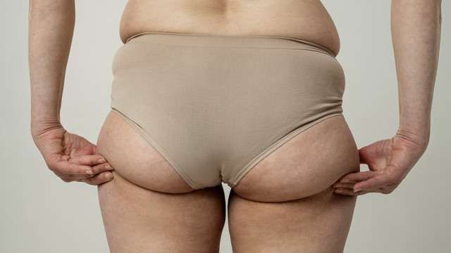 Ушки не на макушке. Как убрать жировые отложения на бедрах?