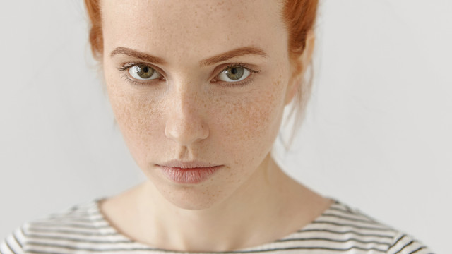 Поцелуй солнца – оставить или удалить