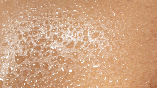 Проблема – жирная кожа, что делать?