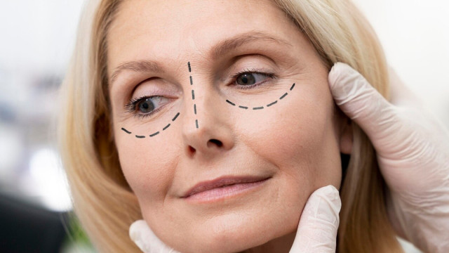 Возможна ли блефаропластика без операции?