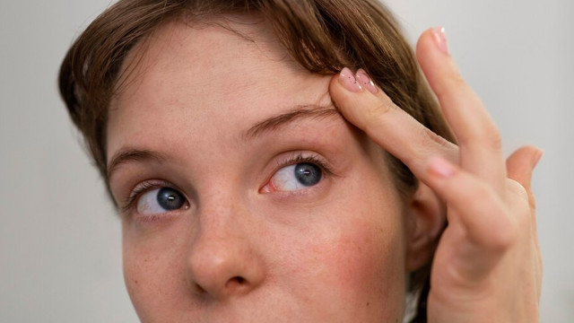 Как убрать морщины на лбу?