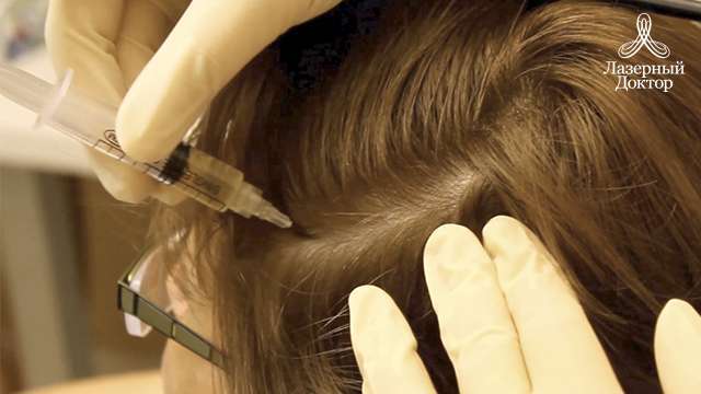 мезотерапия