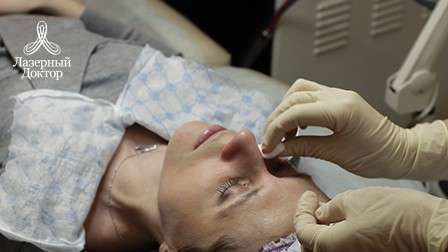 кислотные пилинги