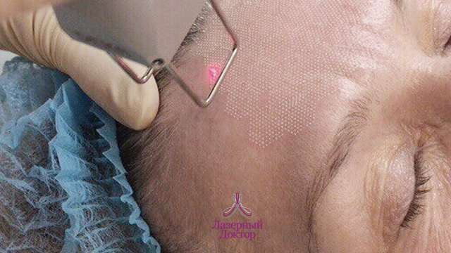 дот омоложение