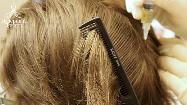 плазмолифтинг