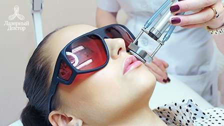 лазерная эпиляция