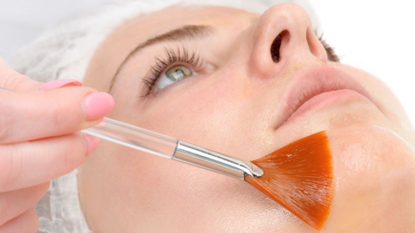 Пилинг Джесснера - что это?