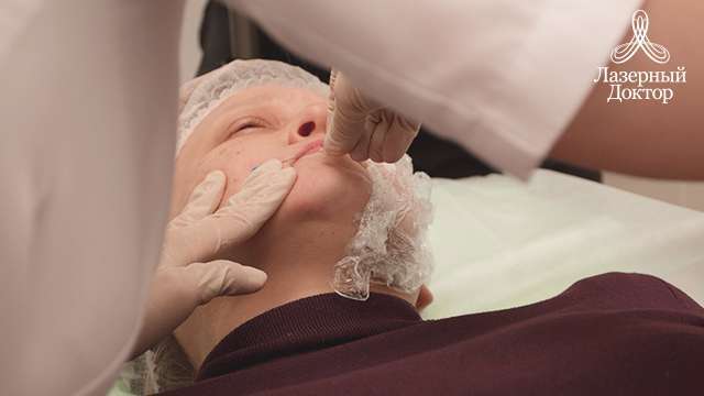 подтяжка лица без операции