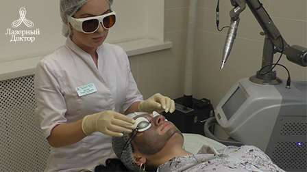 карбоновый пилинг