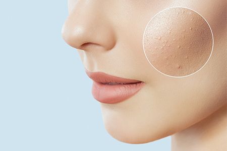 Комбинированная чистка лица что это