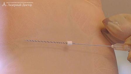 Точную стоимость подтяжки груди может назвать только врач после осмотра.