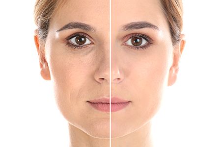 Польза янтарной кислоты для женщин