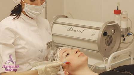 Алмазная дермабразия