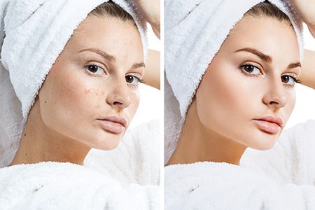 Алмазная шлифовка