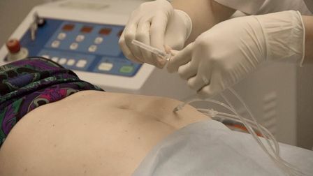 Озонотерапия - что это?