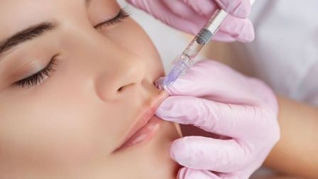 Что такое филлеры?