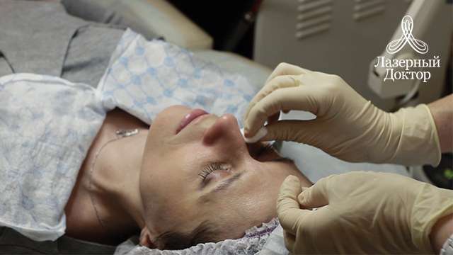 Что такое пилинг