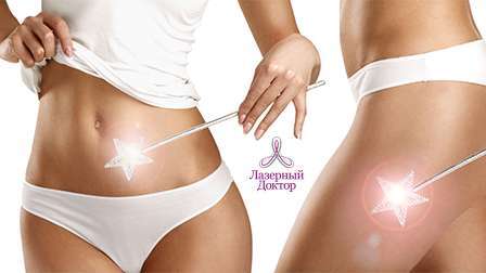 результат Vela Shape