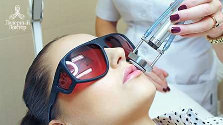 лазерная эпиляция