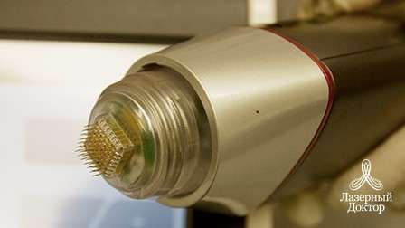 радиочастотное воздействие