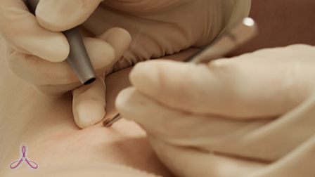 к какому врачу обращаться при новообразовании на коже