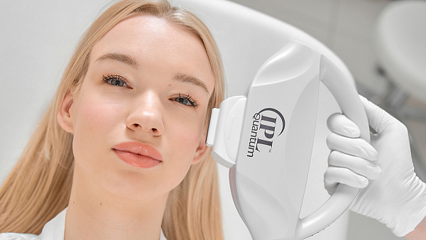 Удаление пигментных пятен