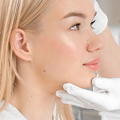 Лечение купероза