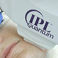 IPL-фотоомоложение: что это, кому подходит и какого эффекта ждать